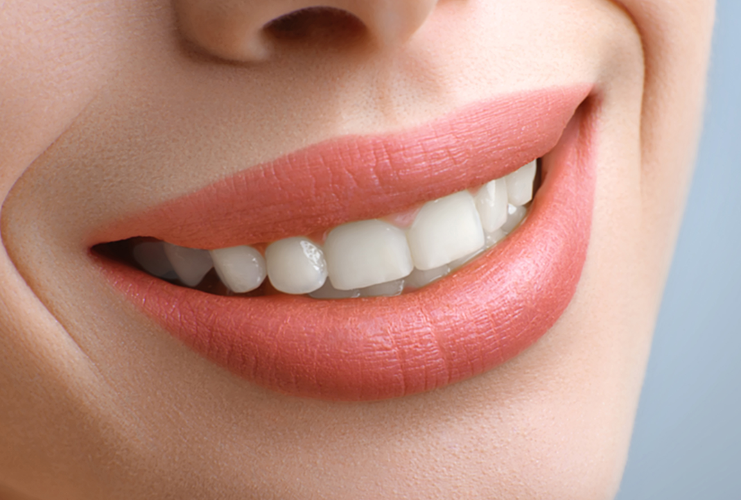 smile2